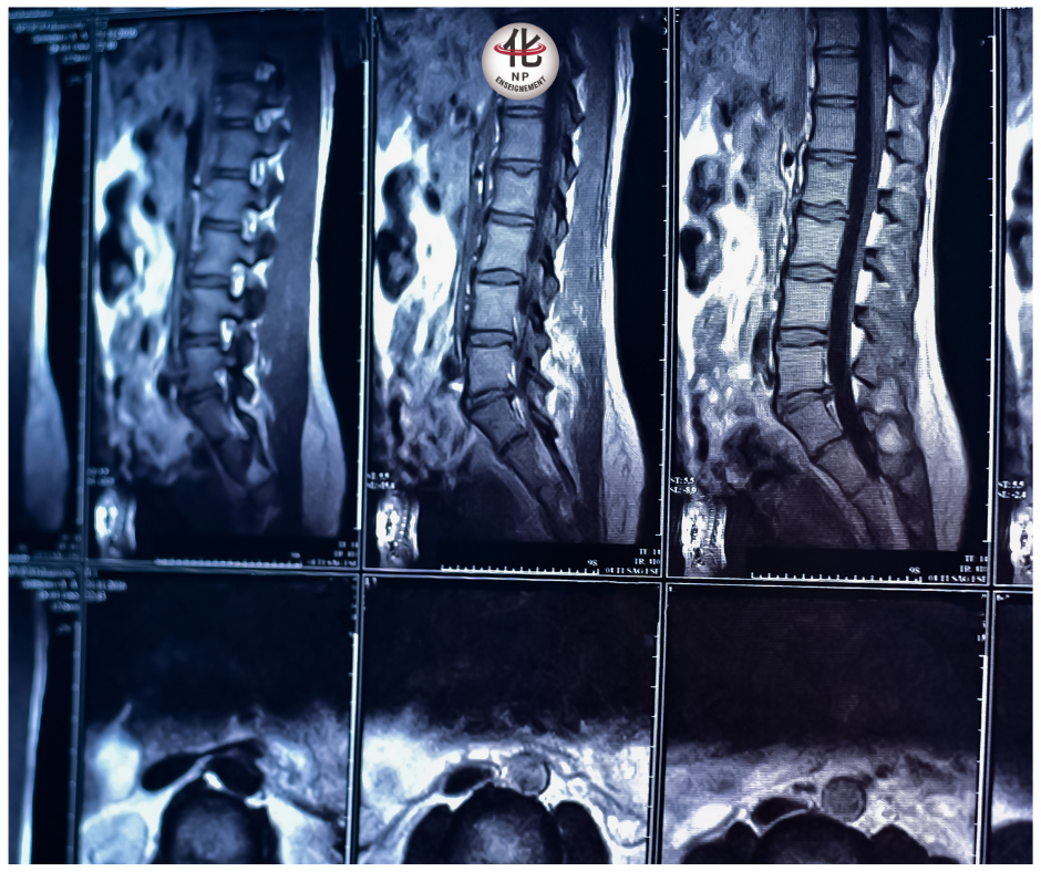 IRM de la colonne lombaire montrant une imagerie normale sans anomalie visible