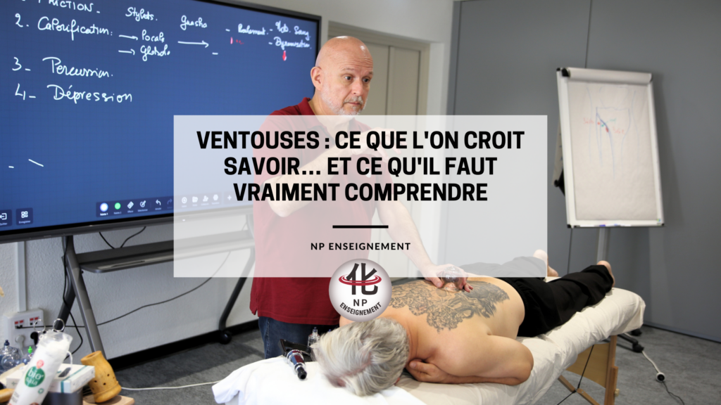 Les ventouses ne sont pas qu'une tendance. Découvrez leur histoire, leur place en médecine chinoise, leurs indications, leurs limites et les précautions d'utilisation.