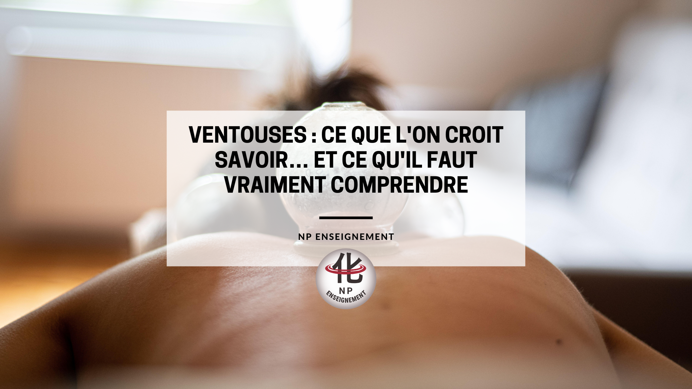 Ventouses en verre utilisées en médecine chinoise lors d'un traitement thérapeutique
