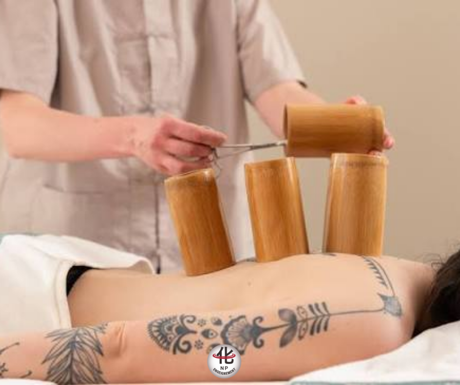 Illustration de la pratique traditionnelle des ventouses en médecine chinoise